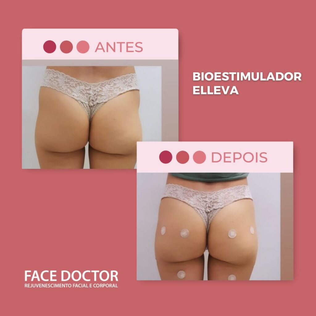 Bioestimulador Elleva