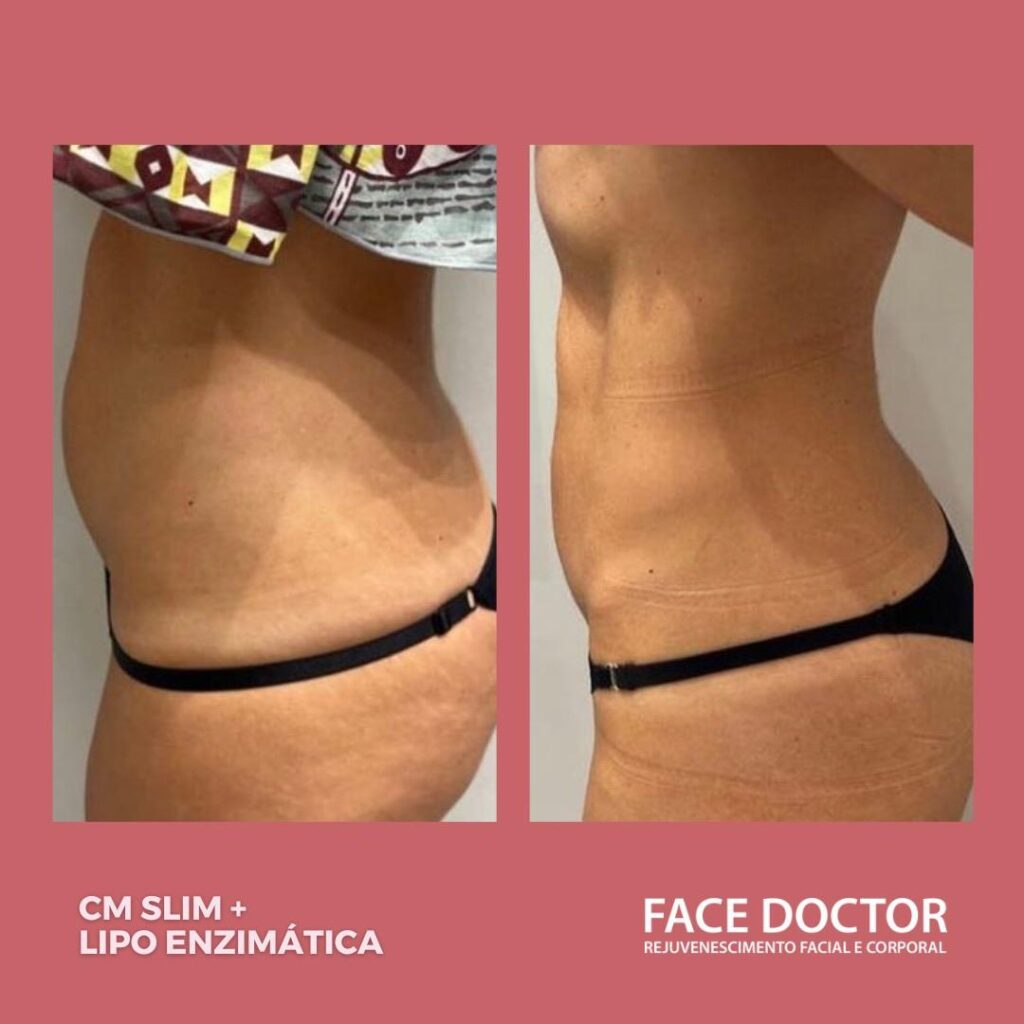 CS SLIM + LIPO ENZIMATIC
