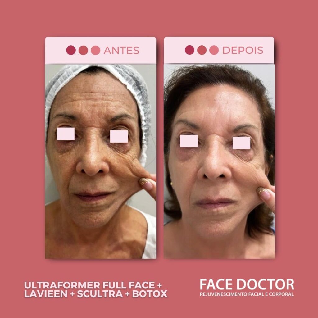 UF Full Face 4