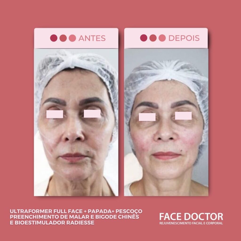 UF Fullface + papada